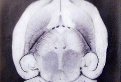 MRI for Mouse Brain Disorder Check-up
